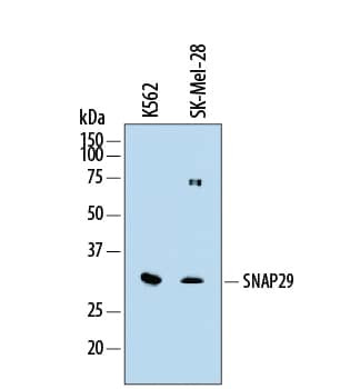 SNAP29 Antibody in Western Blot (WB)