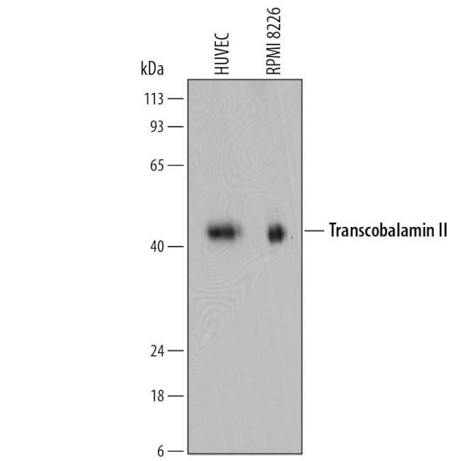 TCN2 Antibody in Western Blot (WB)