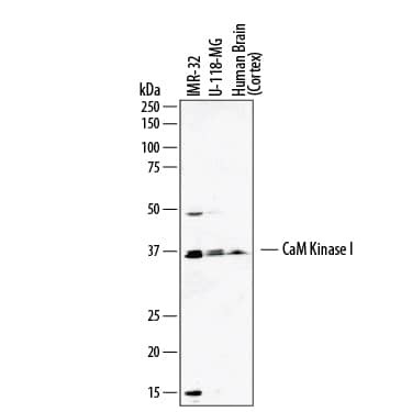 CaMKI Antibody in Western Blot (WB)