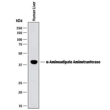 AADAT Antibody in Western Blot (WB)