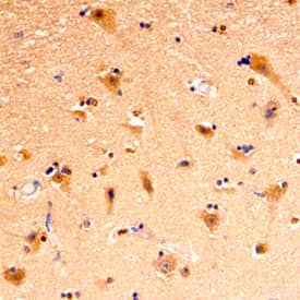 PCLO Antibody in Immunohistochemistry (Paraffin) (IHC (P))