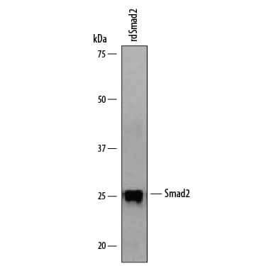 SMAD2 Antibody in Western Blot (WB)