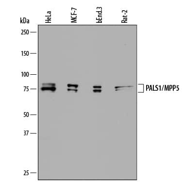 MPP5 Antibody in Western Blot (WB)