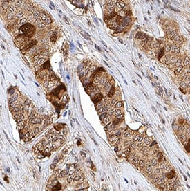TK1 Antibody in Immunohistochemistry (Paraffin) (IHC (P))