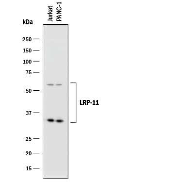 LRP11 Antibody in Western Blot (WB)