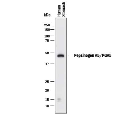 PGA5 Antibody in Western Blot (WB)