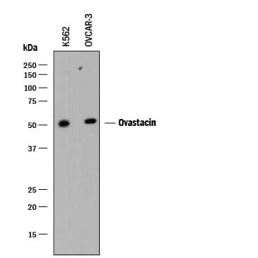 ASTL Antibody in Western Blot (WB)