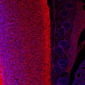 GDF6 Antibody in Immunohistochemistry (Frozen) (IHC (F))