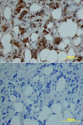 MMP8 Antibody in Immunohistochemistry (Paraffin) (IHC (P))