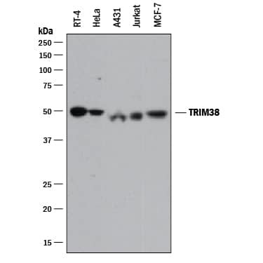 TRIM38 Antibody in Western Blot (WB)