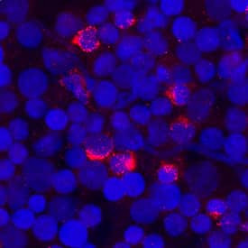 FGFBP2 Antibody in Immunocytochemistry (ICC/IF)