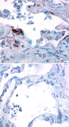 Angiopoietin 4 Antibody in Immunohistochemistry (Paraffin) (IHC (P))