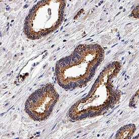 TBK1 Antibody in Immunohistochemistry (Paraffin) (IHC (P))