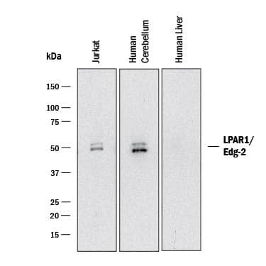 EDG2 Antibody in Western Blot (WB)