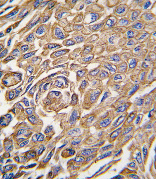 ALDH3A1 Antibody in Immunohistochemistry (Paraffin) (IHC (P))