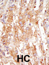 MEKK6 Antibody in Immunohistochemistry (Paraffin) (IHC (P))