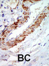 TPL2 Antibody in Immunohistochemistry (Paraffin) (IHC (P))