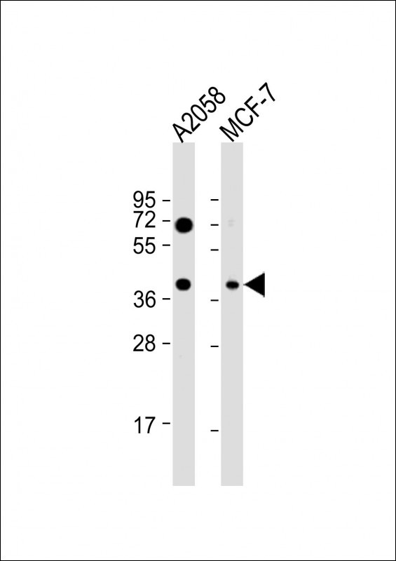 GNA12 Antibody in Western Blot (WB)