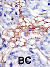 PIP4K2A Antibody in Immunohistochemistry (Paraffin) (IHC (P))