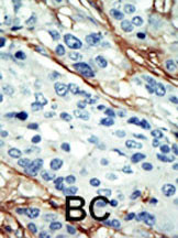 ARK5 Antibody in Immunohistochemistry (Paraffin) (IHC (P))