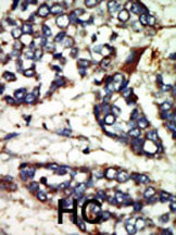 NEK1 Antibody in Immunohistochemistry (Paraffin) (IHC (P))