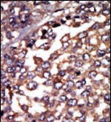 PRKAR1A Antibody in Immunohistochemistry (Paraffin) (IHC (P))