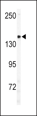 ULK2 Antibody in Western Blot (WB)