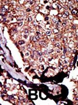 DGKB Antibody in Immunohistochemistry (Paraffin) (IHC (P))
