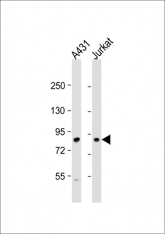 DGKA Antibody in Western Blot (WB)