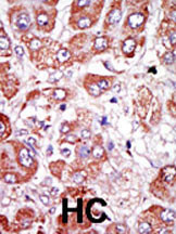 uPAR Antibody in Immunohistochemistry (Paraffin) (IHC (P))