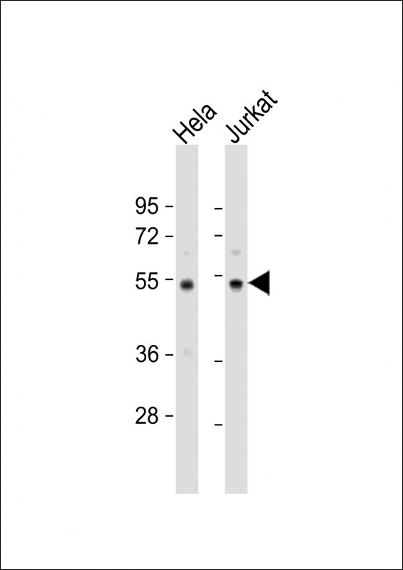 PTP1B Antibody in Western Blot (WB)