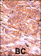 CTDSP2 Antibody in Immunohistochemistry (Paraffin) (IHC (P))
