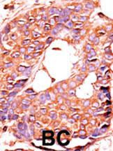 PPP6C Antibody in Immunohistochemistry (Paraffin) (IHC (P))