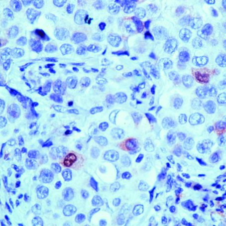 Cyclin B1 Antibody in Immunohistochemistry (IHC)