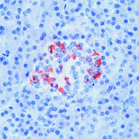 Somatostatin Antibody in Immunohistochemistry (IHC)