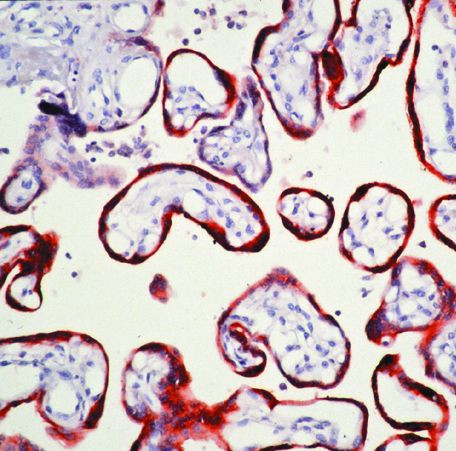 hCG beta Antibody in Immunohistochemistry (Paraffin) (IHC (P))