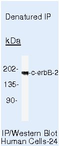 ErbB2 (HER-2) Antibody in Immunoprecipitation (IP)