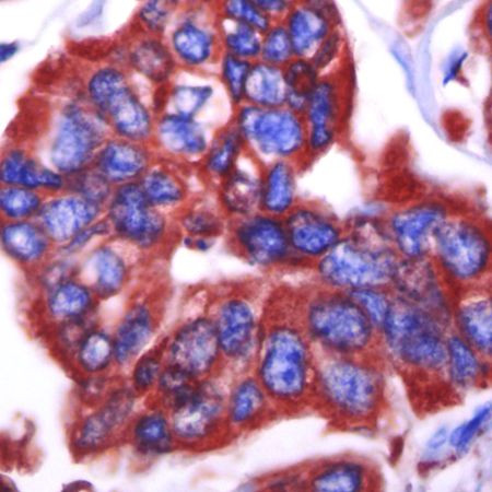 GRP94 Antibody in Immunohistochemistry (IHC)