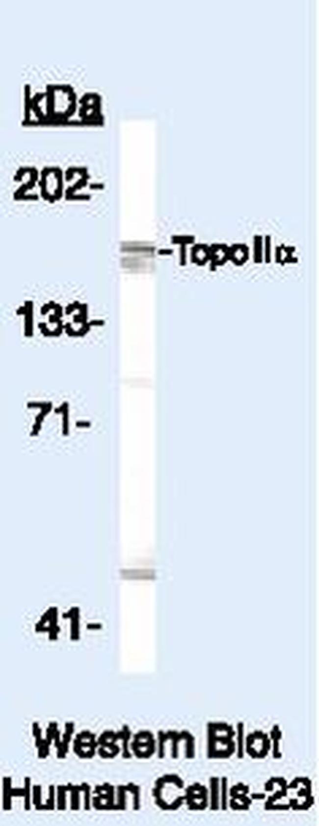 TOP2A Antibody in Western Blot (WB)