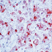 HSV Type 2 Antibody in Immunohistochemistry (IHC)