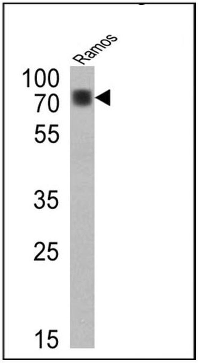 Human IgD (Heavy chain) Secondary Antibody in Western Blot (WB)