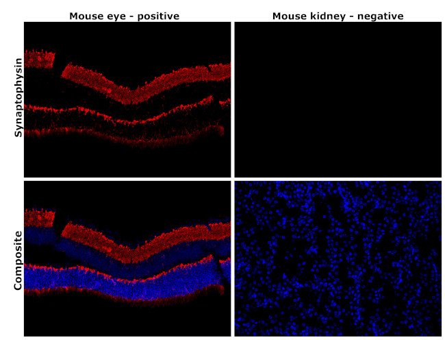 Synaptophysin Antibody in Immunohistochemistry (Paraffin) (IHC (P))