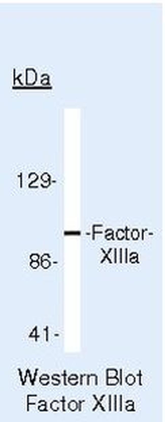 Factor XIII A Antibody in Western Blot (WB)