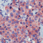 beta Catenin Antibody in Immunohistochemistry (Paraffin) (IHC (P))