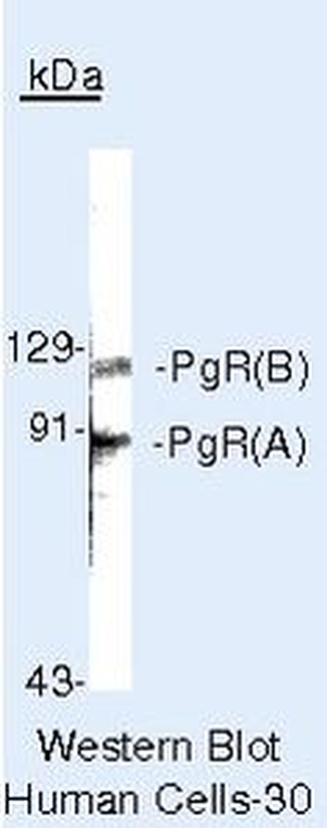 Progesterone Receptor Antibody in Western Blot (WB)