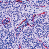 BAK Antibody in Immunohistochemistry (Paraffin) (IHC (P))
