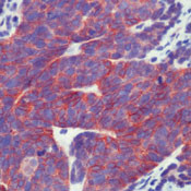 Pan-cadherin Antibody in Immunohistochemistry (Paraffin) (IHC (P))