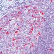Cyclin A Antibody in Immunohistochemistry (Paraffin) (IHC (P))