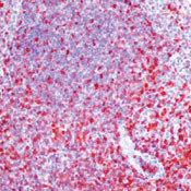 S100A4 Antibody in Immunohistochemistry (IHC)