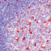 S100A6 Antibody in Immunohistochemistry (Paraffin) (IHC (P))